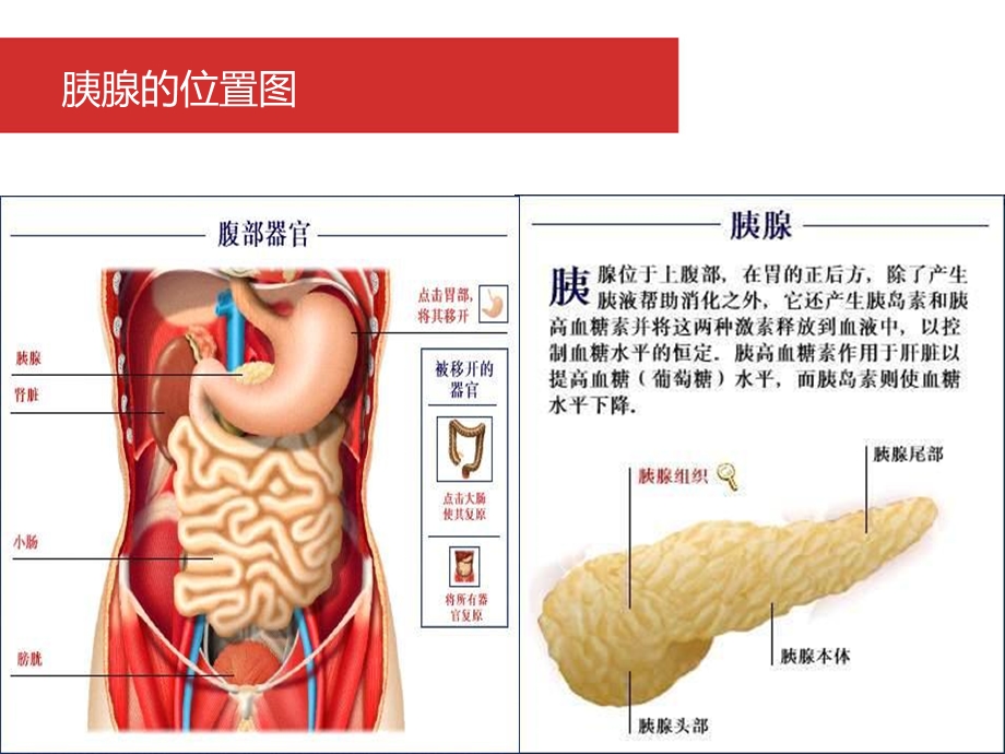 急性胰腺炎的护理(讲课).ppt_第3页