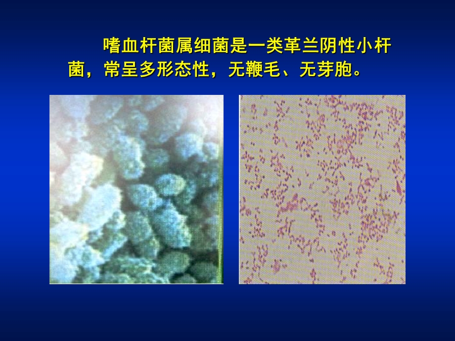 第15章 嗜血杆菌属.ppt_第2页