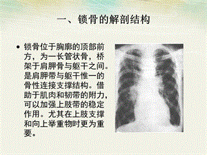 锁骨骨折病人的护理.ppt