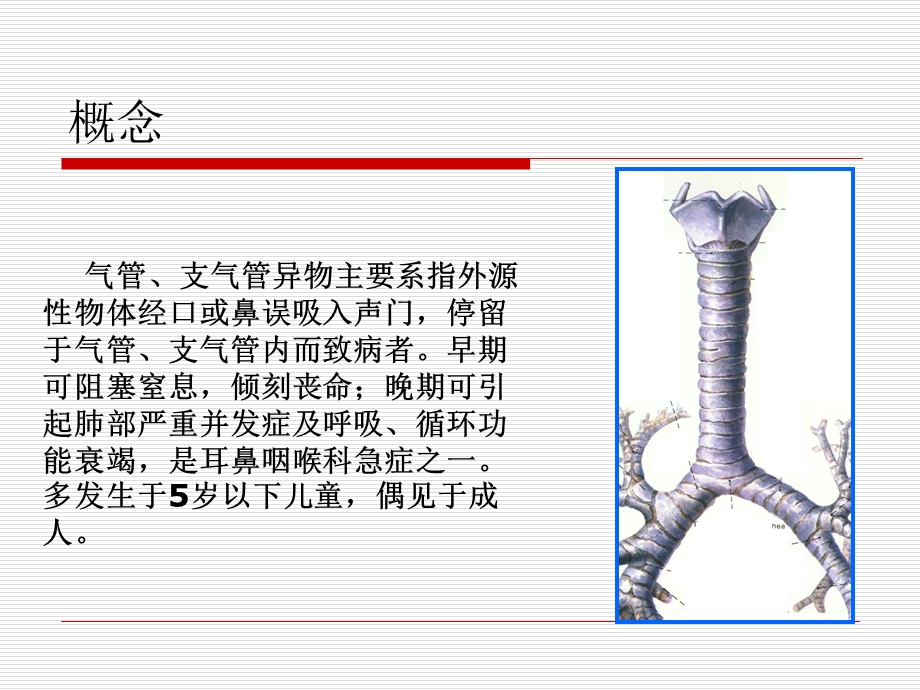 气管支气管异物.ppt_第3页