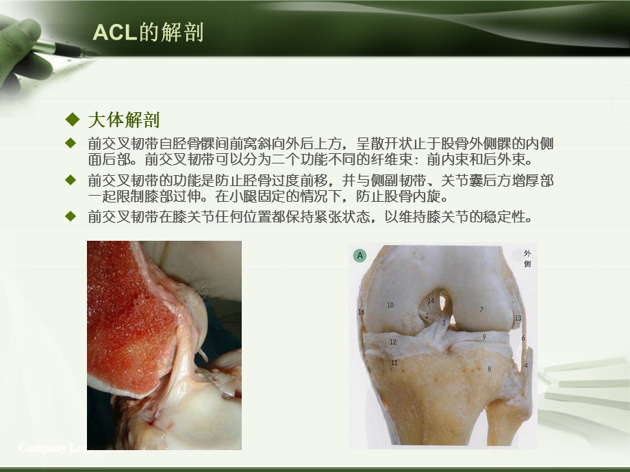 ACL损伤影像学诊断.ppt_第1页