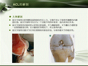 ACL损伤影像学诊断.ppt