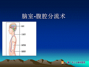 脑室腹腔分流术.ppt