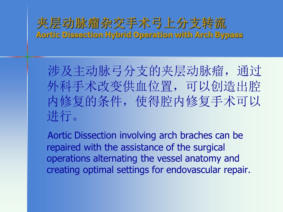 Arch pass in Hybrid Operation for Aortic Dissection：对主动脉夹层的杂交手术弓旁路.ppt_第2页