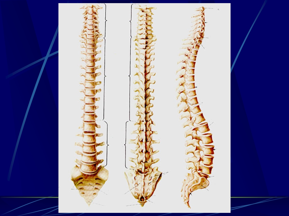 13脊柱区断层解剖及CT、MRI.ppt_第3页