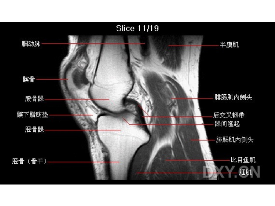 膝关节解剖.ppt_第1页