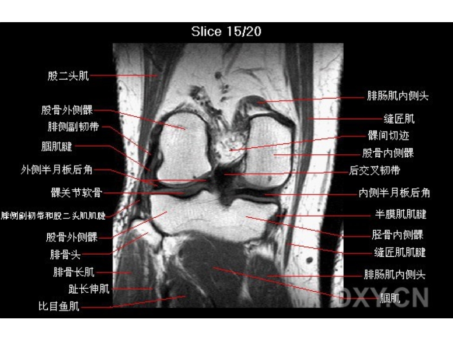 膝关节解剖.ppt_第3页