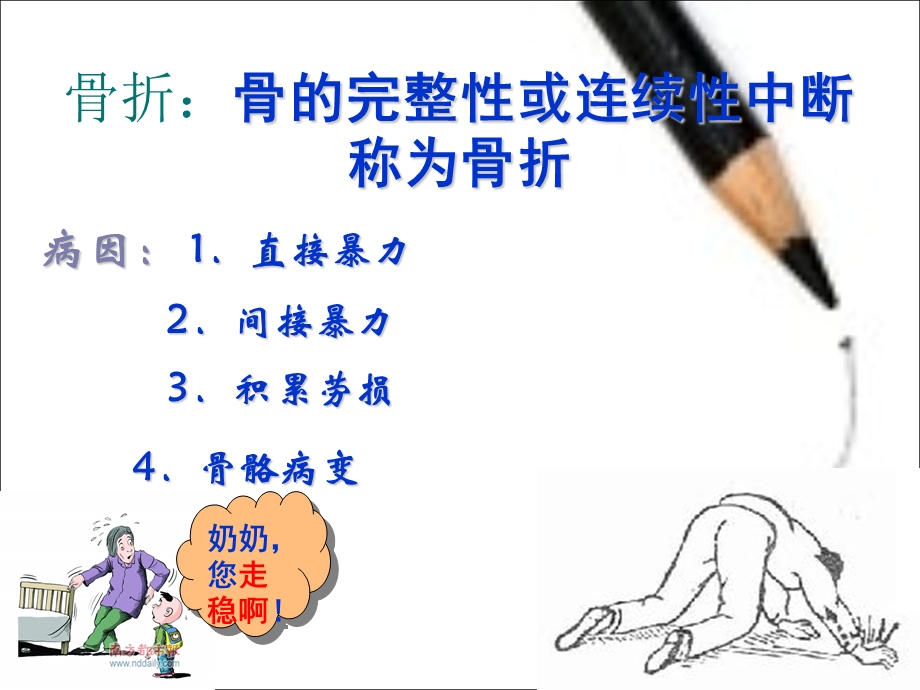 股骨粗隆间骨折的护理.ppt_第3页