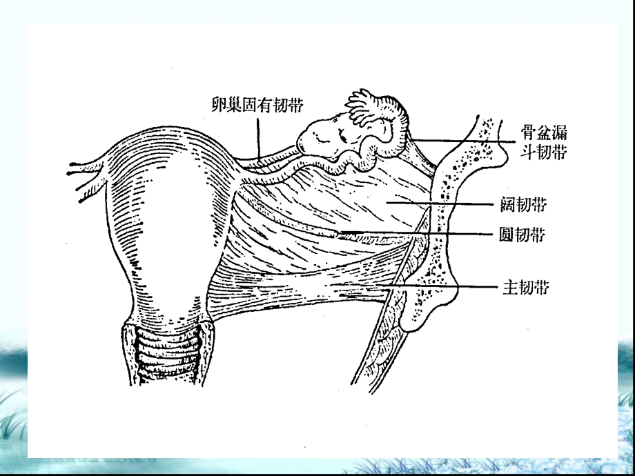 子宫脱垂.ppt_第3页