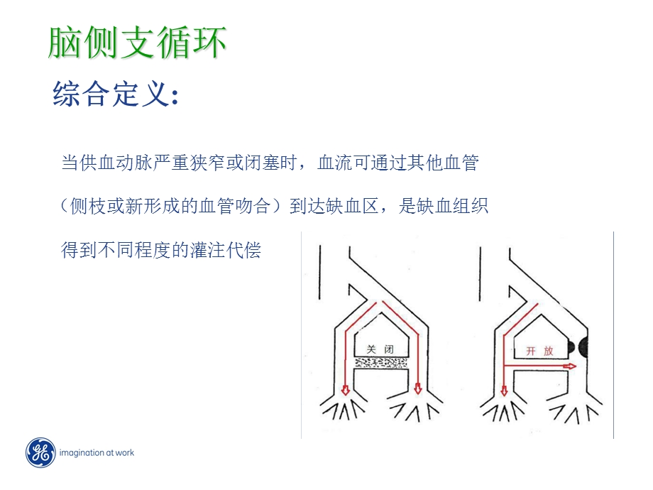 缺血性脑卒中的侧支循环评估.ppt_第2页