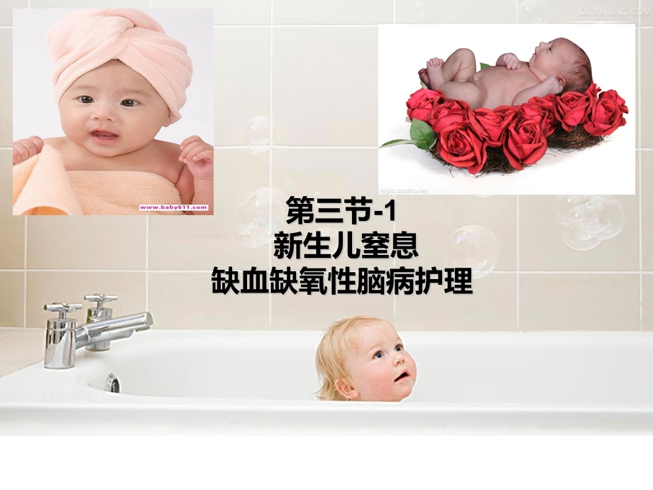 新生儿缺血缺氧性脑病护理.ppt_第1页