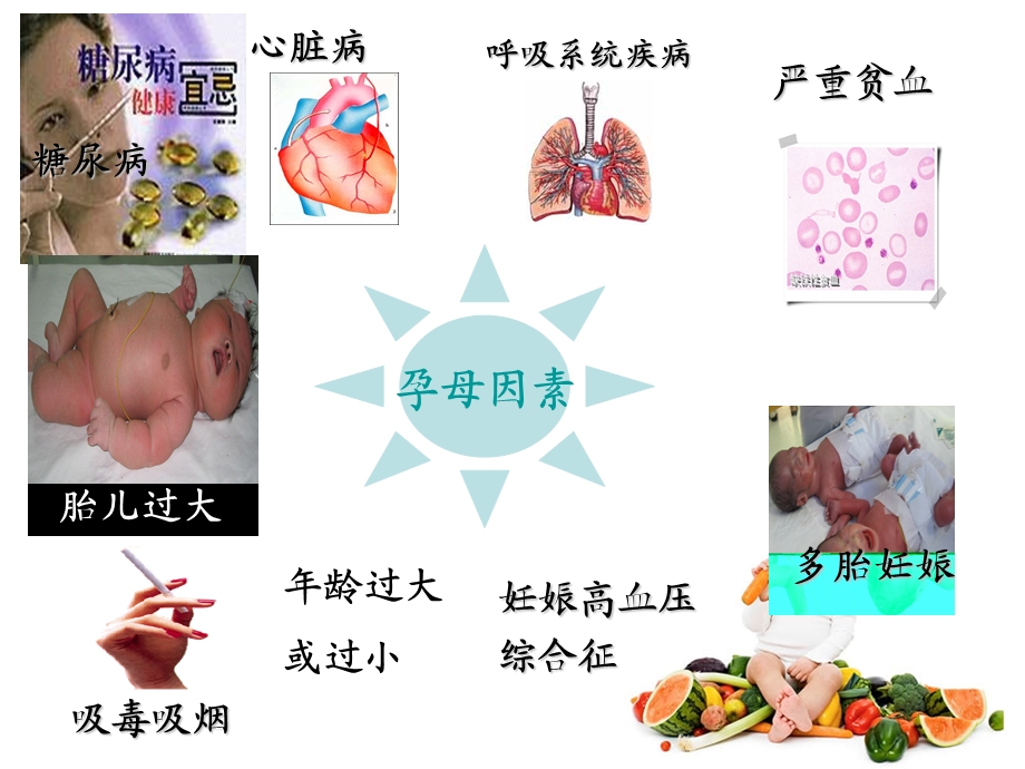 新生儿缺血缺氧性脑病护理.ppt_第3页