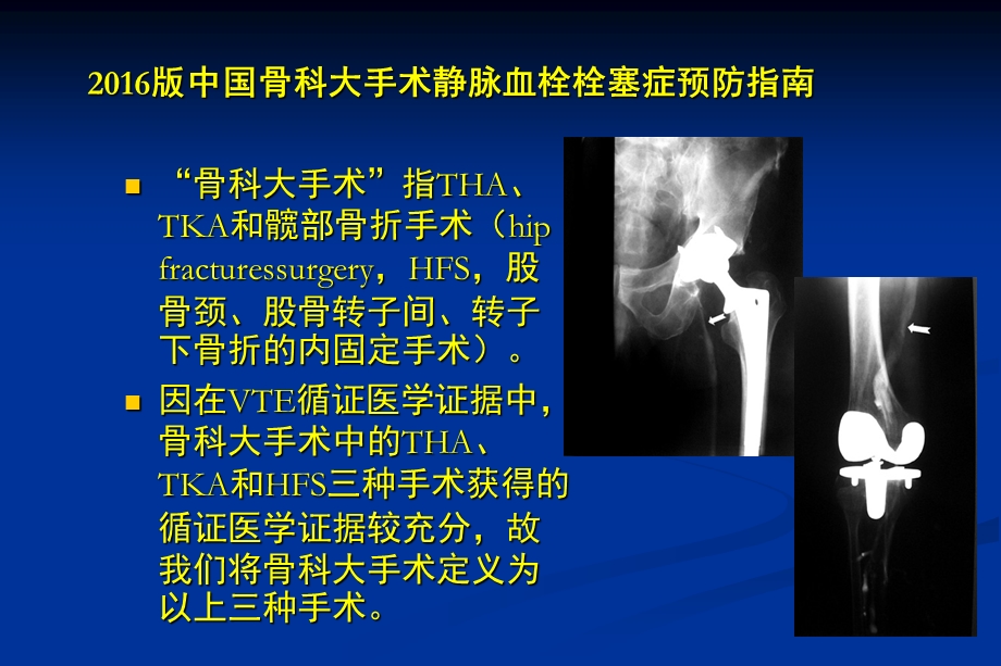 中国骨科大手术静脉血栓栓塞症预防指南解读.ppt_第3页