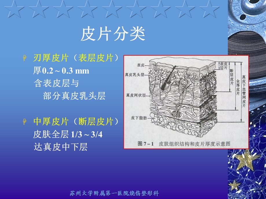 医学资料皮片移植.ppt_第3页