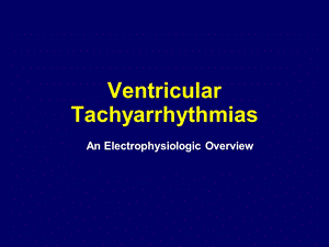 室性心律失常EP综述（英文版） .ppt