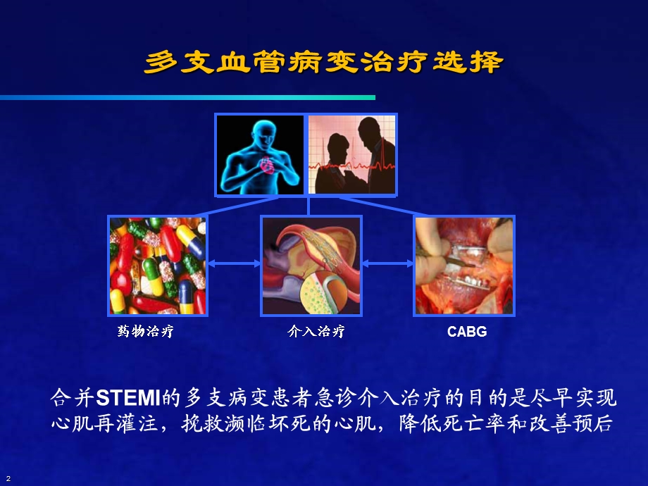 合并多支血管病变的STEMI介入治疗策略.ppt_第2页