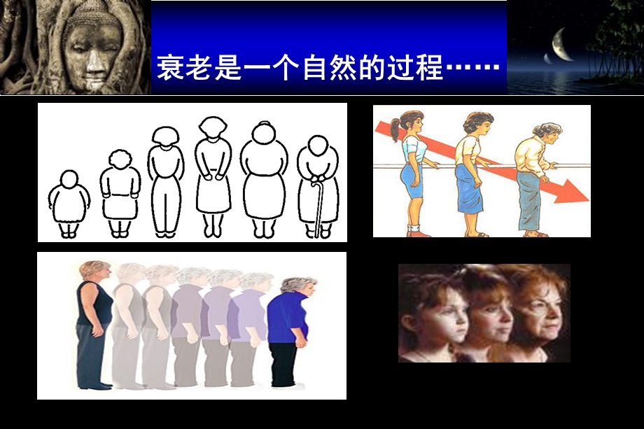 围绝经期综合征.ppt.ppt_第2页