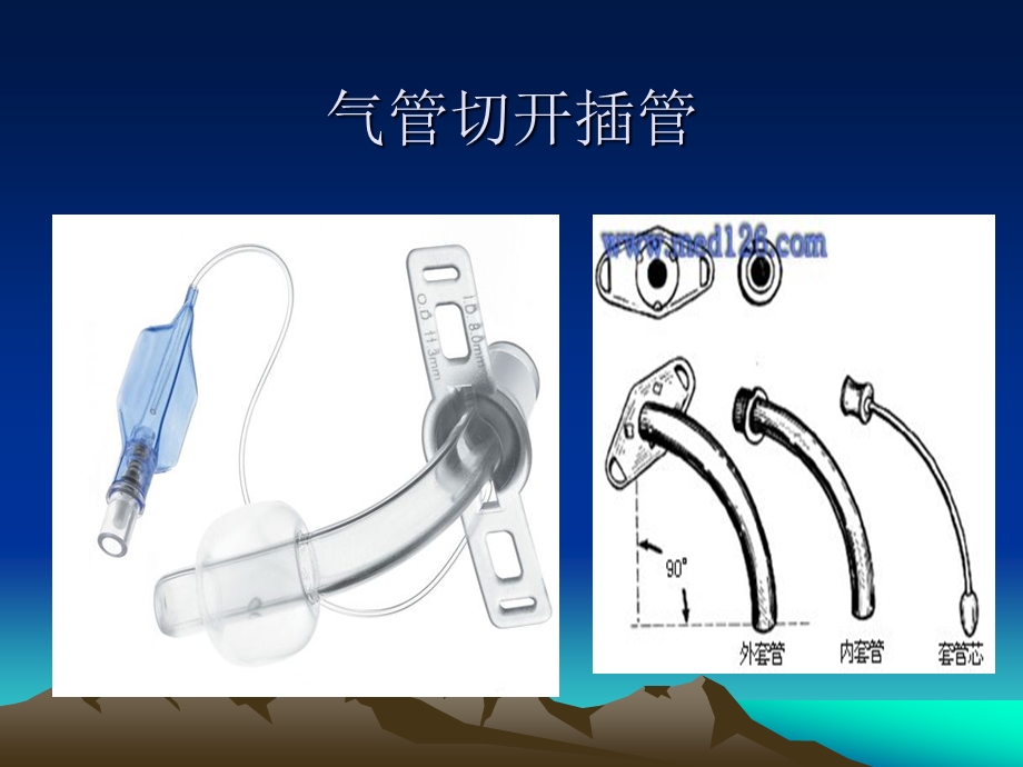 .7气管切开护理_第3页