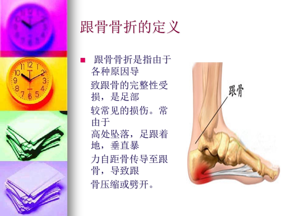 跟骨骨折病人的护理.ppt_第2页