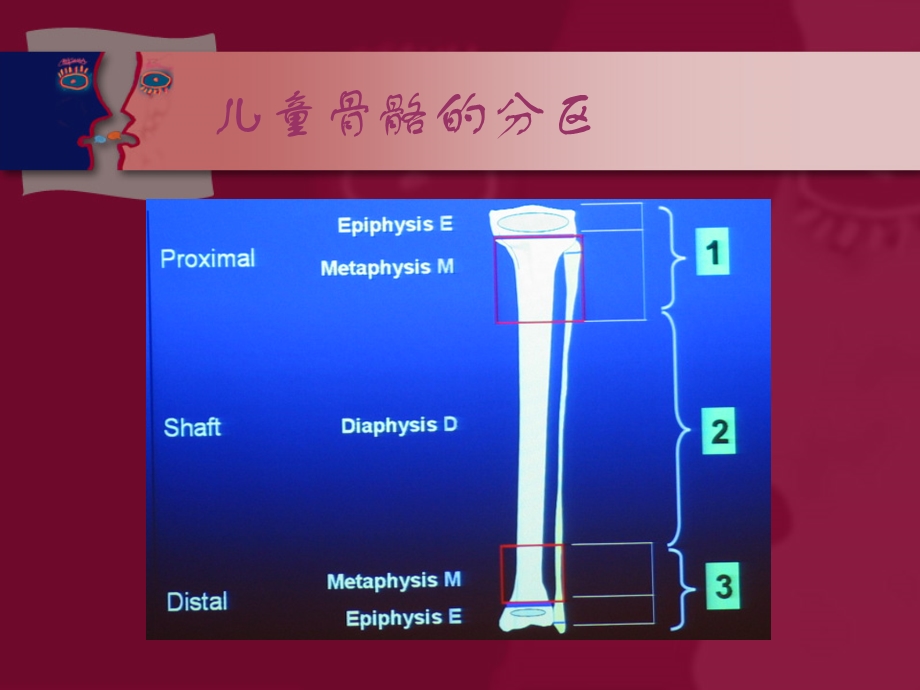 小儿骨科读片.ppt_第2页