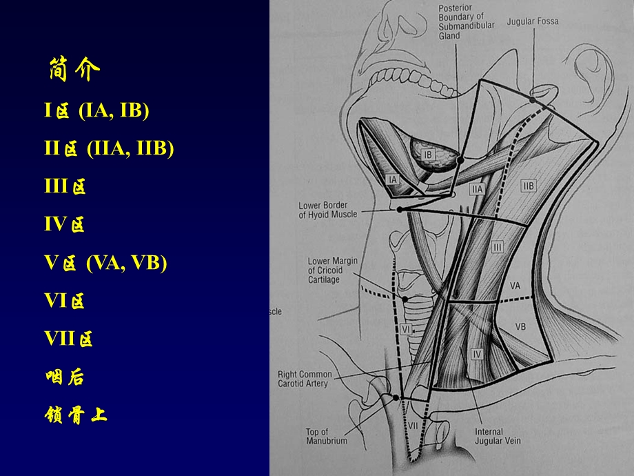 颈淋巴结影像新分区法的应用价值.ppt_第3页