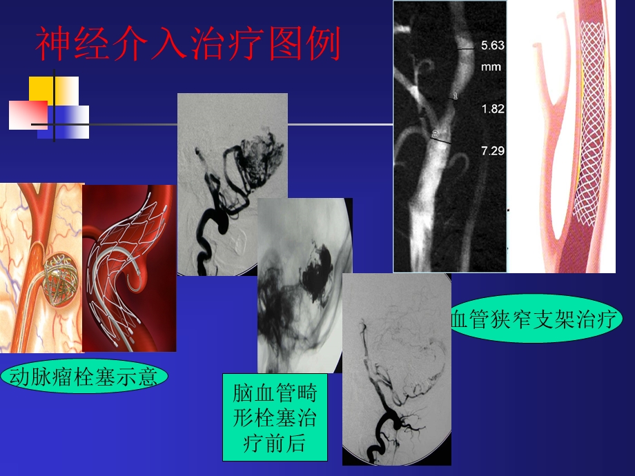 神经外科宣传栏2.ppt_第2页