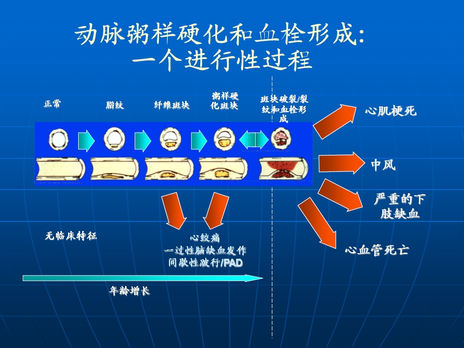 泰嘉硫酸氢氯吡格雷.ppt_第3页