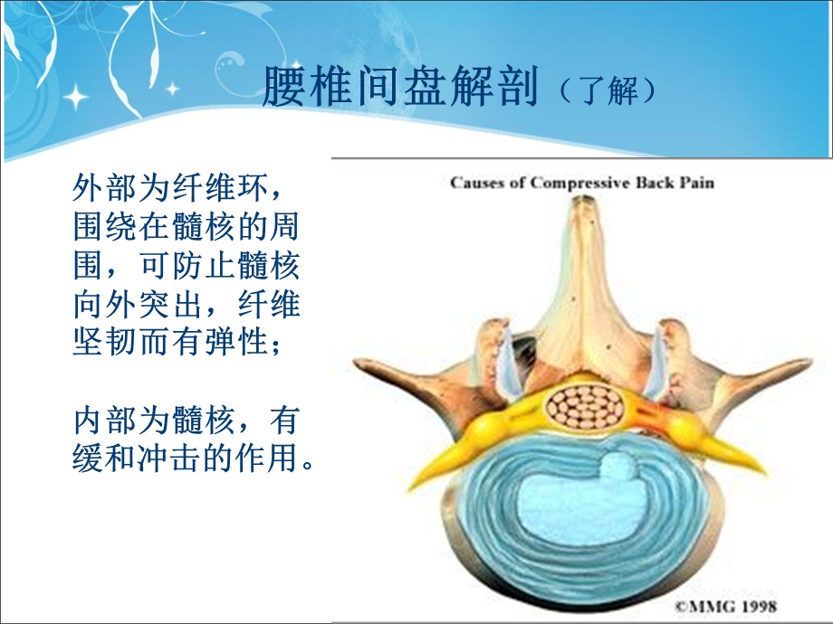 腰椎间盘突出症术后护理.ppt_第3页