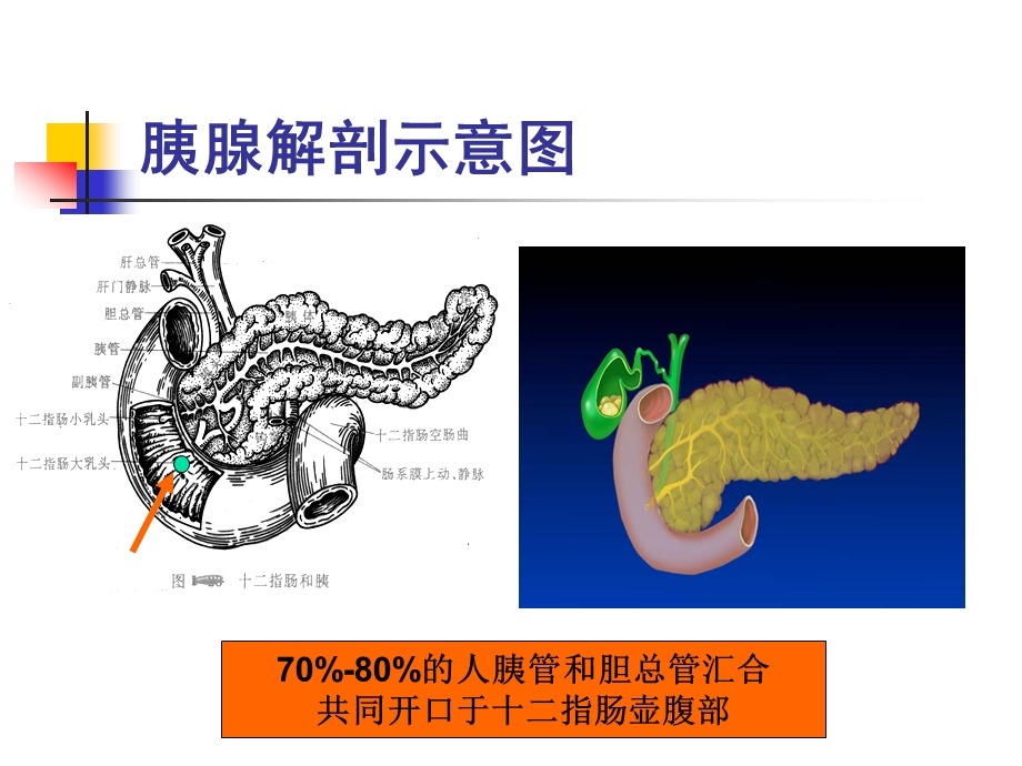 急性胰腺炎诊治.ppt.ppt_第3页