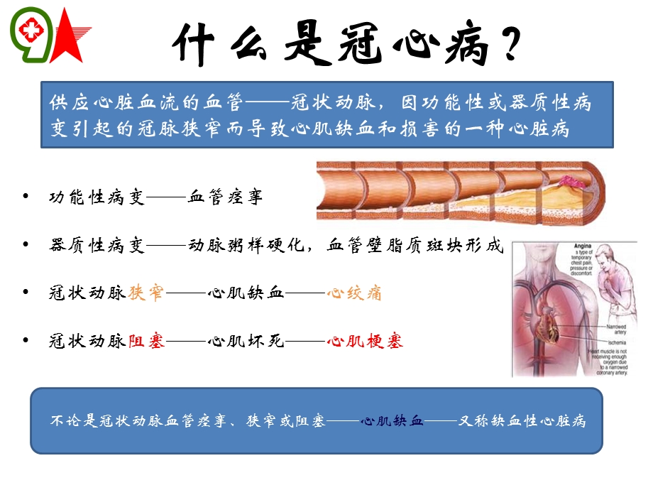 冠心病的防治教学课件.ppt_第2页