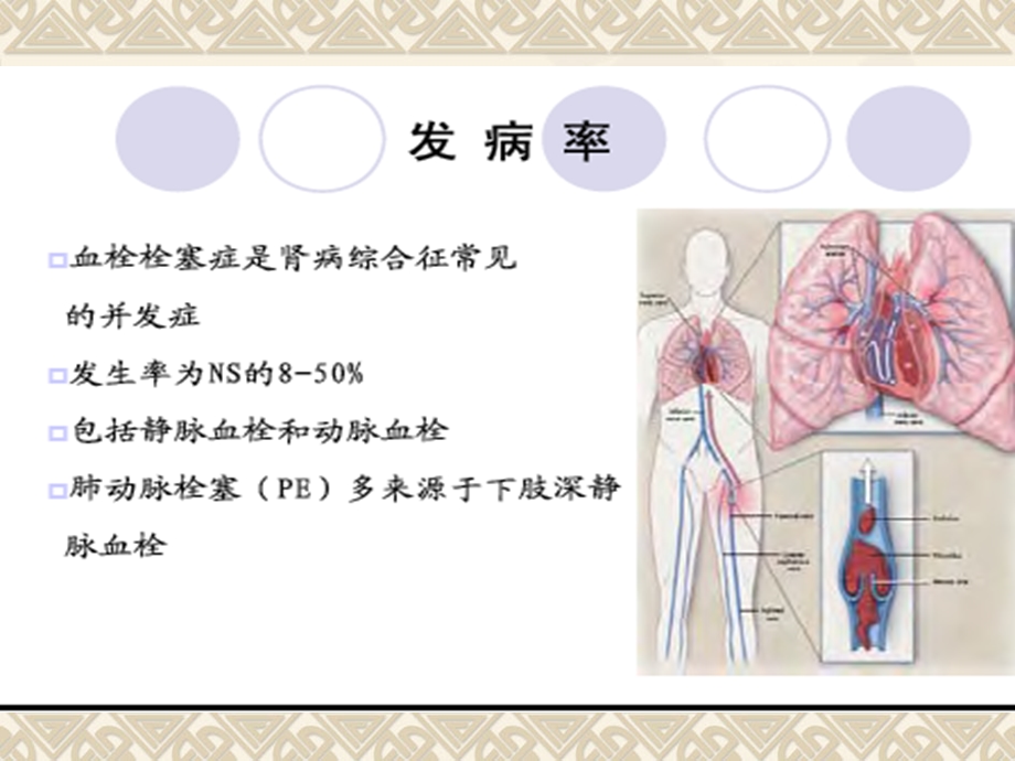 NS血栓栓塞并发症的诊断与治疗.ppt_第3页