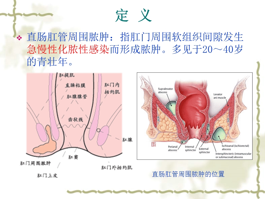 肛周脓肿PPT.ppt_第3页