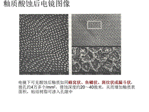 口腔粘结修复技术2.ppt