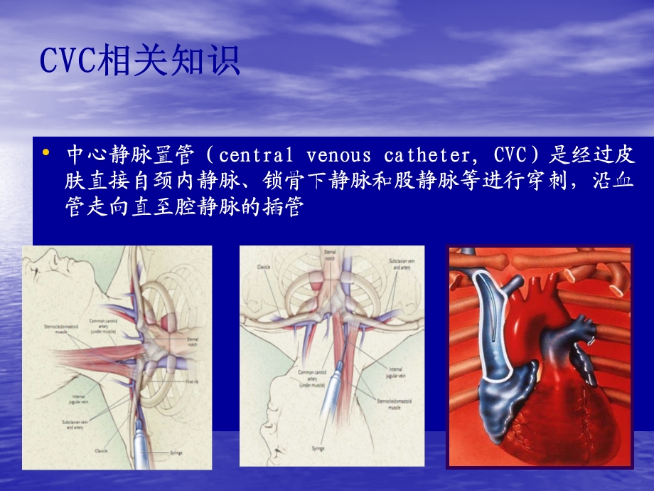 院内静疗专科护士培训班第一期第一课.ppt_第2页