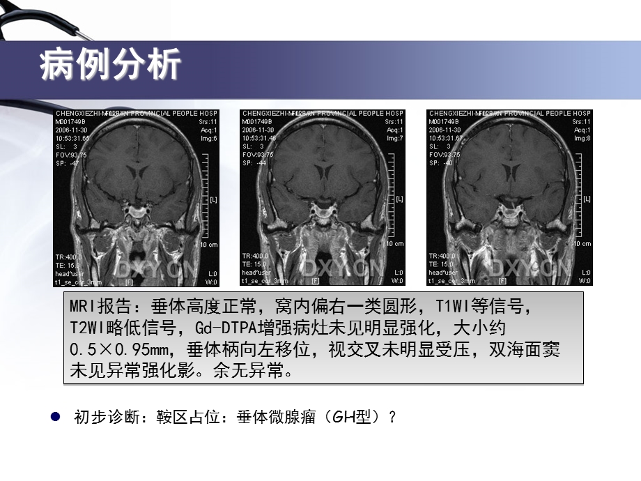 2085091188垂体瘤.ppt.ppt_第3页