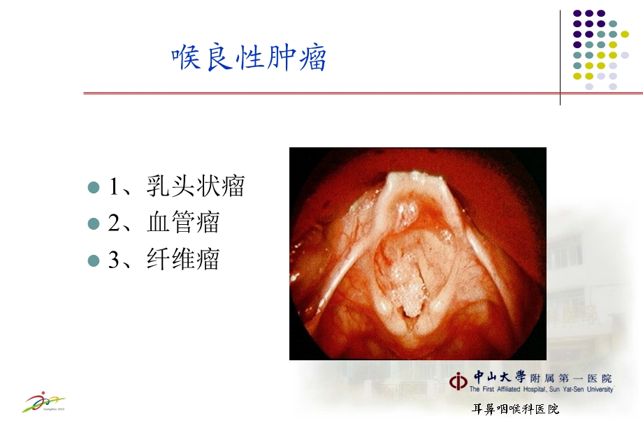 【精品】喉部肿瘤39.ppt_第2页