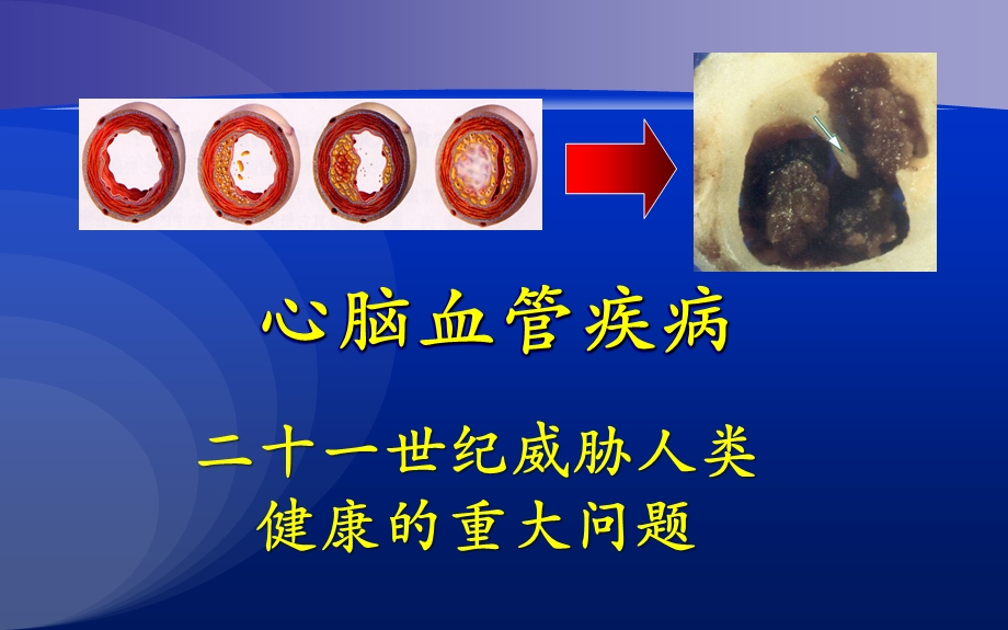 脉搏波传导速度的临床应用荟萃.ppt_第2页