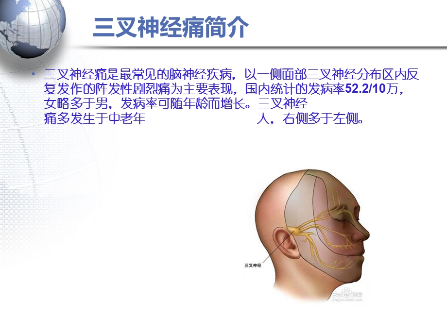 三叉神经痛的手术治疗李鹏精要.ppt_第2页