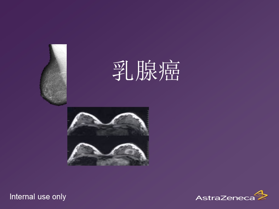 2-乳腺癌基础知识.ppt_第1页