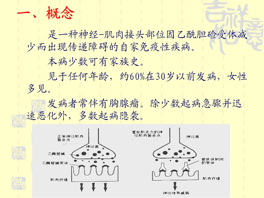 重症肌无力的护理hh.ppt_第2页