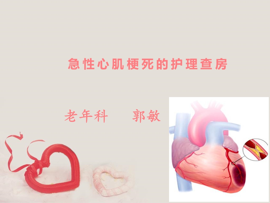 急性心肌梗死的护理查房郭敏.ppt_第1页