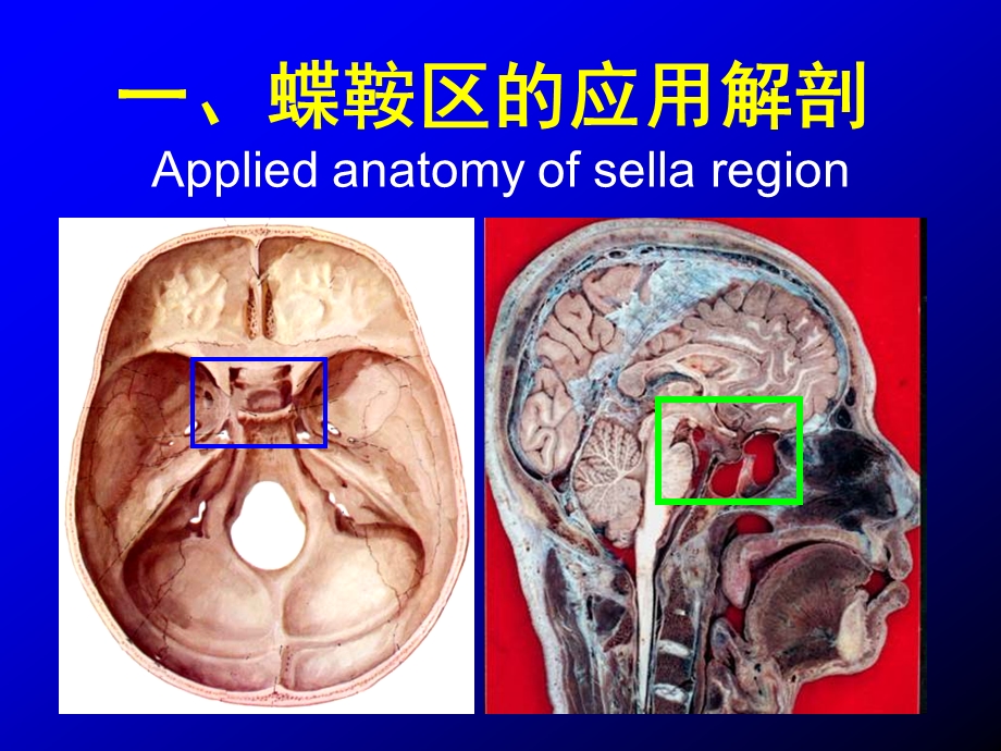 蝶鞍区应用解剖.ppt_第1页