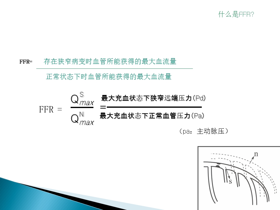 FFR-临床应用.ppt_第2页