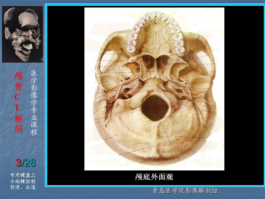 头颈部断层解剖.ppt_第3页