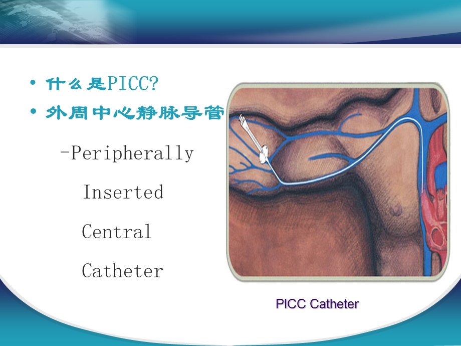 PICC维护过程中常见的并发症.ppt.ppt_第2页