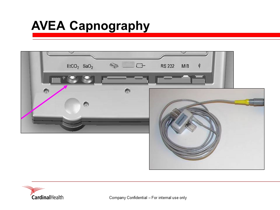 ETCO2(1).ppt_第3页