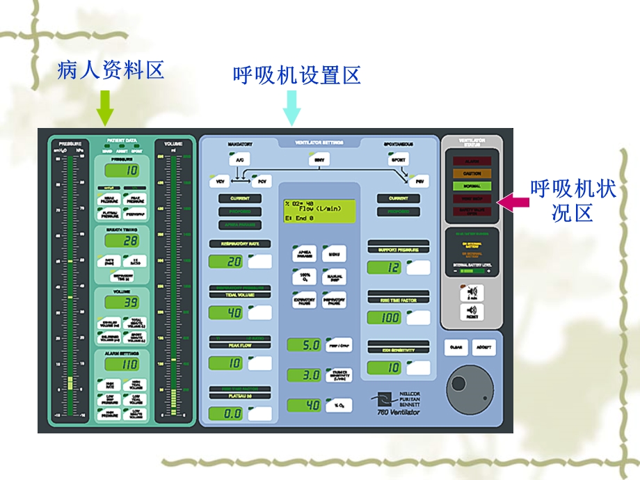 呼吸机在急诊中的应用.ppt_第3页