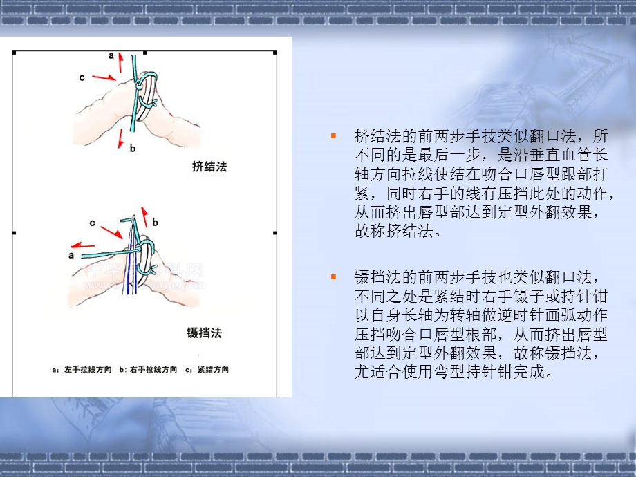 断指再植讲课.ppt_第3页