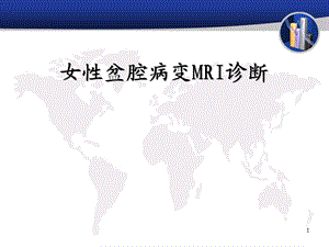 女性盆腔病变MRI诊断.ppt.ppt