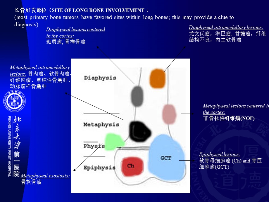 非骨化性纤维瘤.ppt_第3页